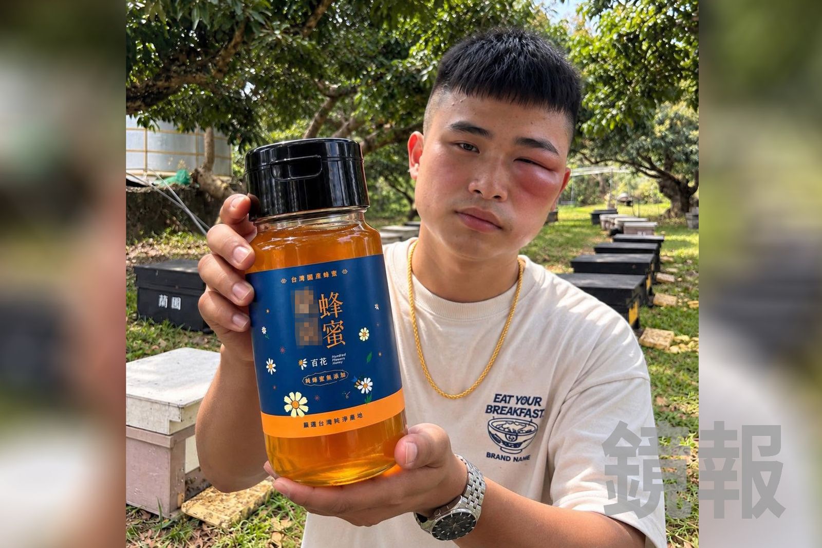 獨家/臉腫成這樣!26歲蜂農遭蜂螫「用這招」自曝慘況 網友笑炸:用生命賣蜂蜜
