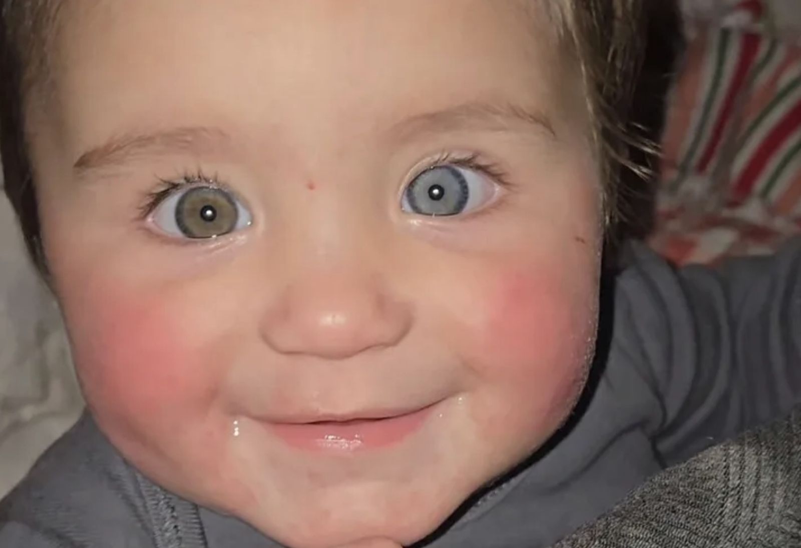 女嬰早產「出生就異色瞳、兩髮色」 疑體內至少有兩套DNA