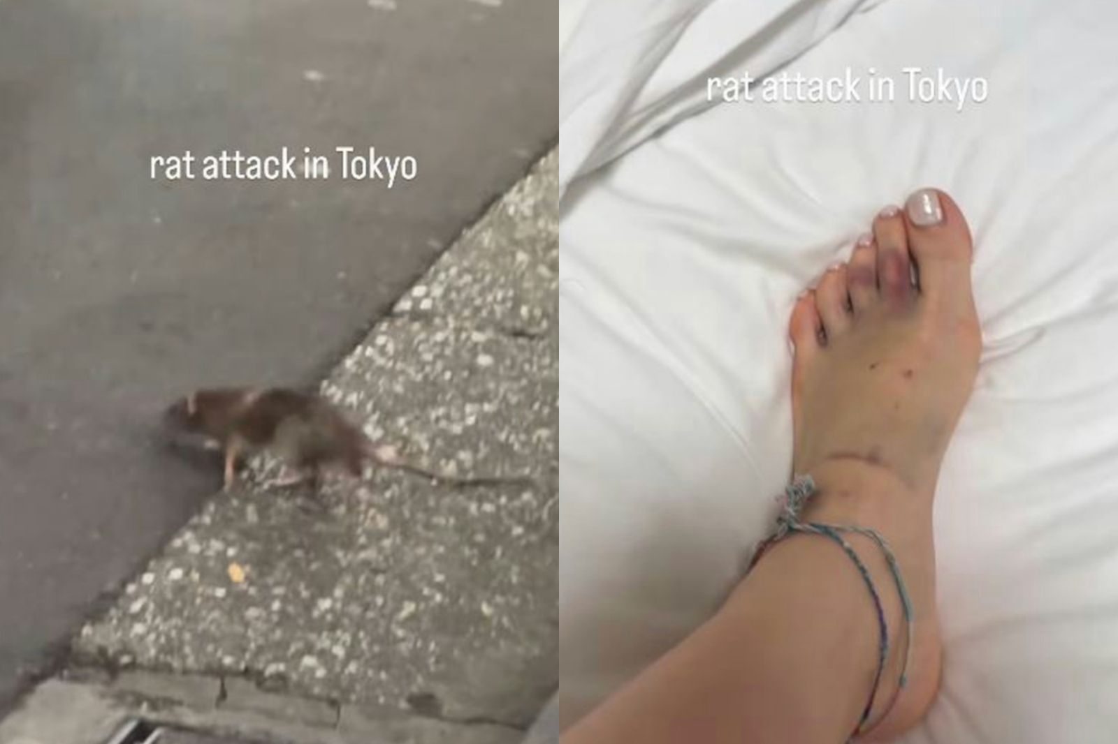 東京街頭慘遭「米奇攻擊」!女遊客腳被咬出大洞當場濺血