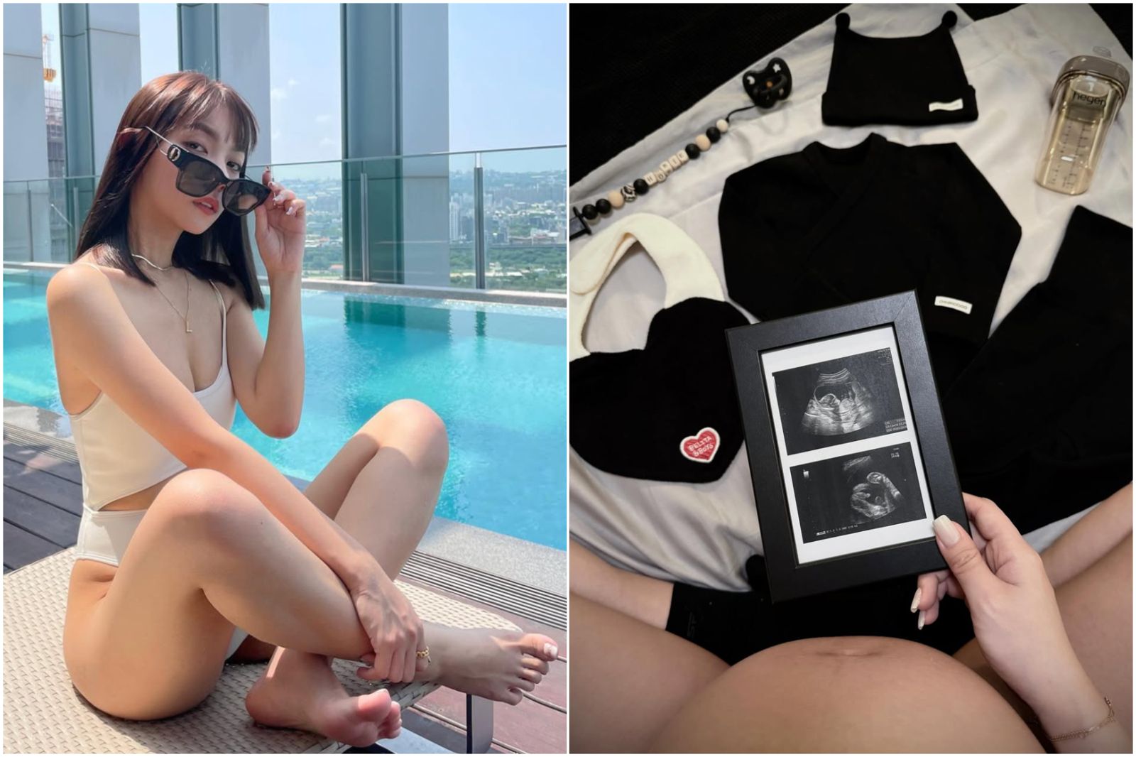 33歲本土女星曬超音波照宣布懷孕!寶寶性別曝光 認了「假戲真做」同劇演員超震驚