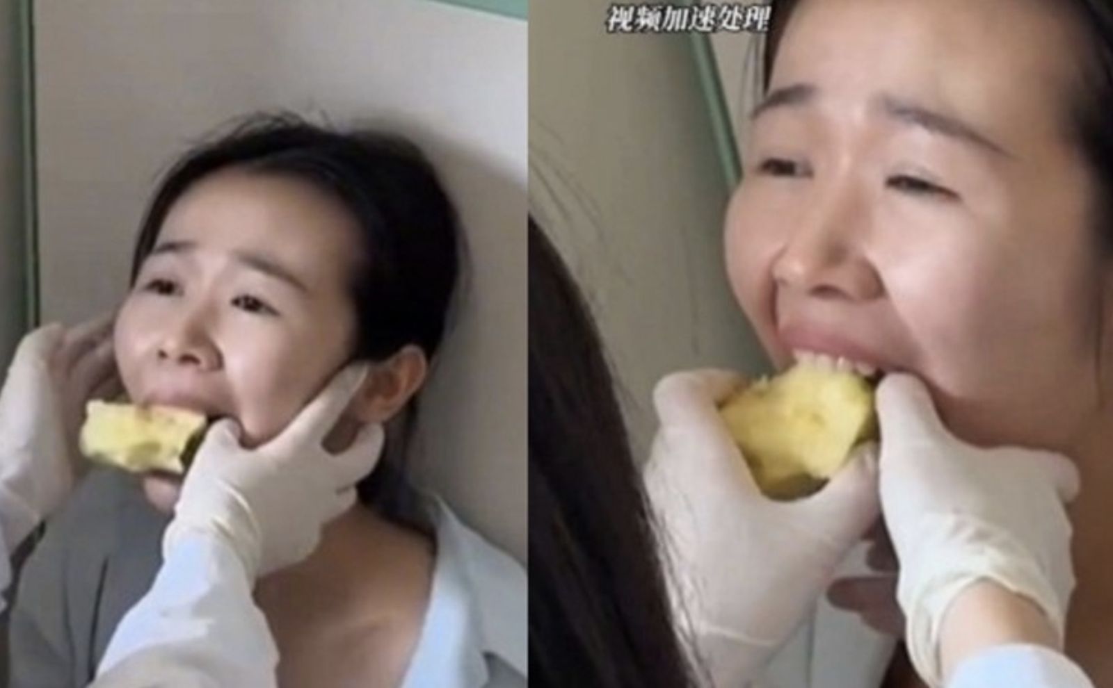 中國浙江一名女子日前洗好蘋果後,沒有切成小塊,而是直接拿起整顆蘋果大口啃食,沒想到才吃到一半,蘋果竟卡在嘴裡。圖/翻攝自微博