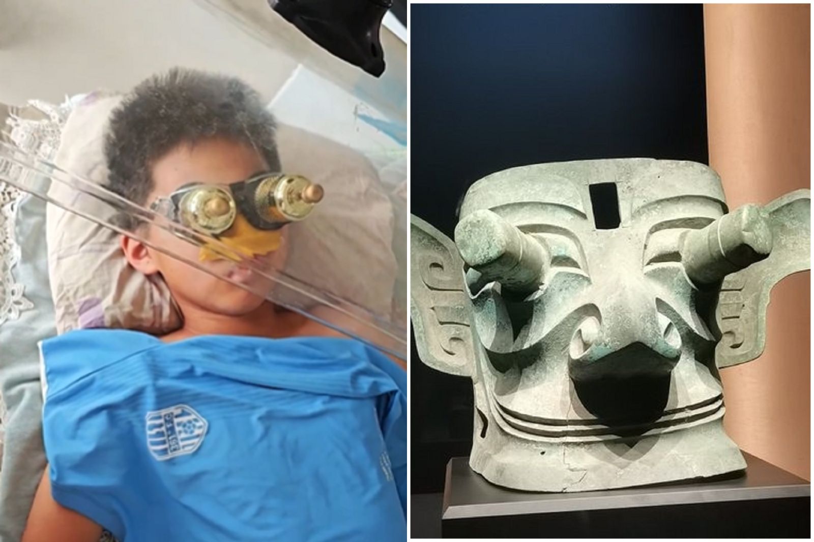 中國人厲害了！用「外星人術」治療近視　網友驚呆