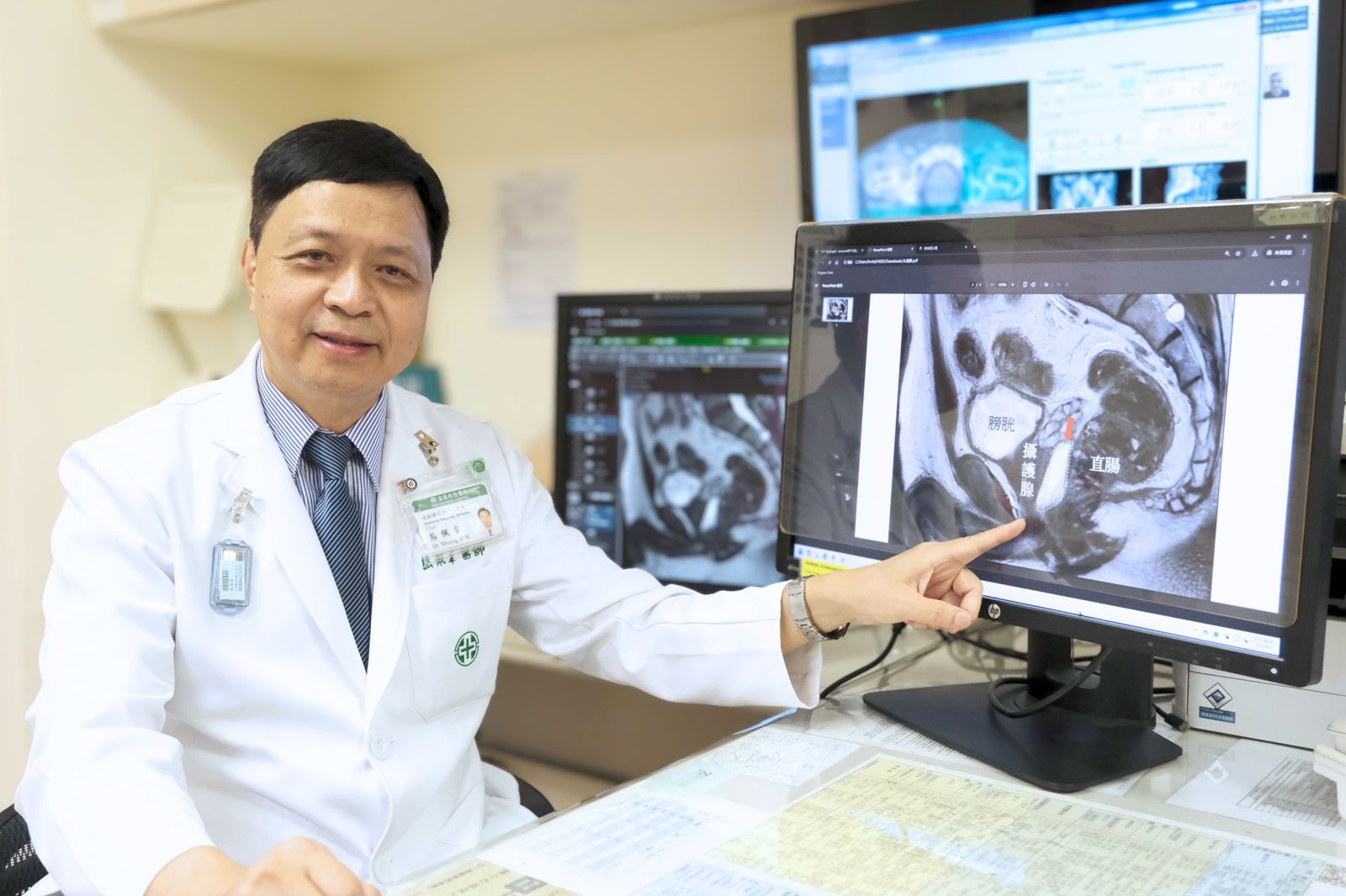 放射腫瘤科醫師熊佩韋指出，5次SBRT療程即可達到傳統放療39次的效果。（亞東醫院供圖）