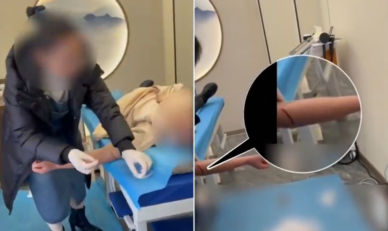 黑診所「排邪氣」插針任血流成泊　行醫者：要放100毫升才會出來