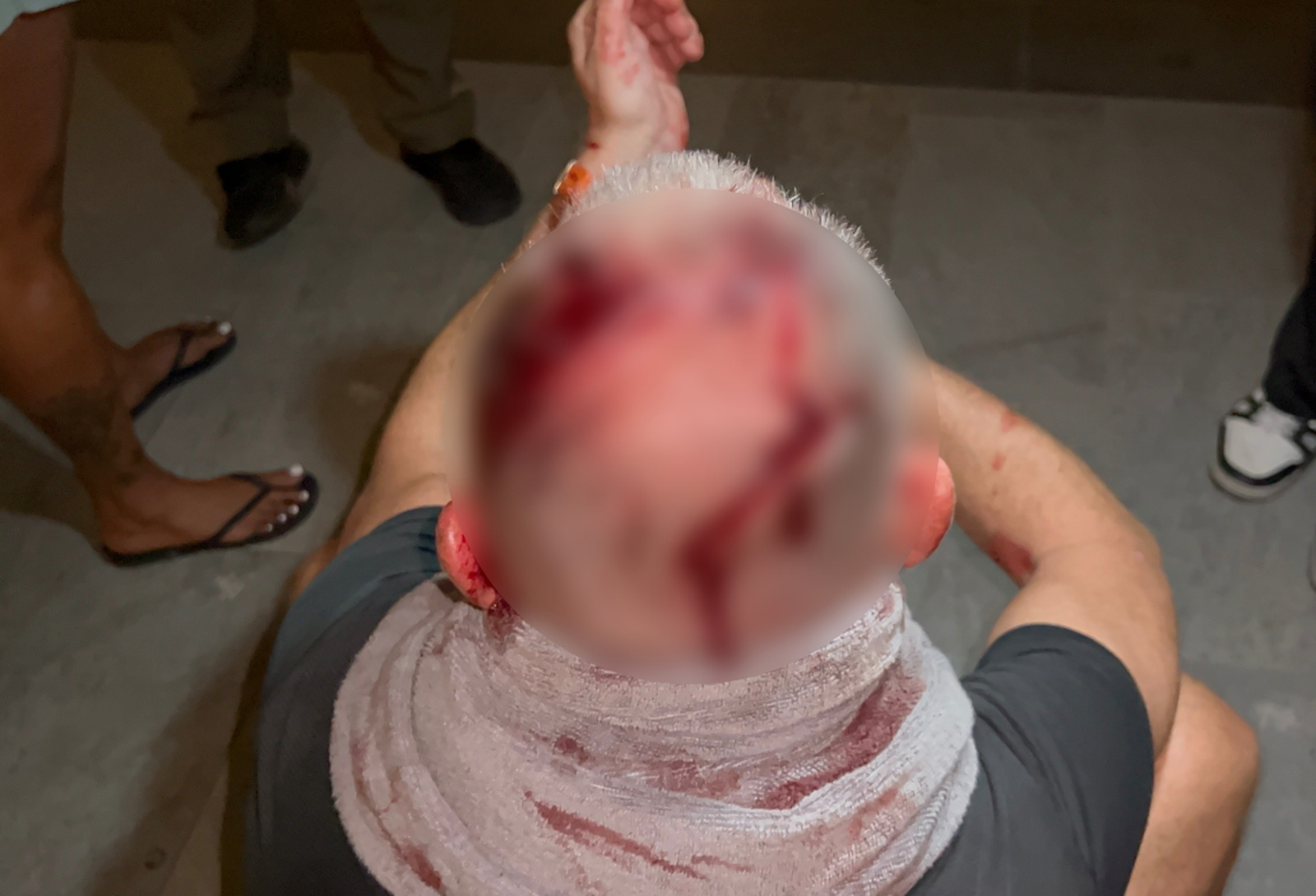 6旬翁請嫩妹卻來「紅姐團」 他不願付錢慘遭圍毆狂砍頭部