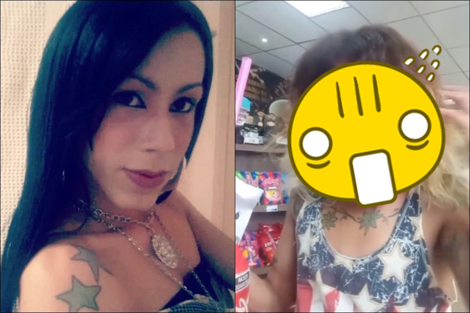 以為是矽膠填充…網紅整形遭注射「礦物油＋瀉藥」！毀容8年驚悚術後照曝光