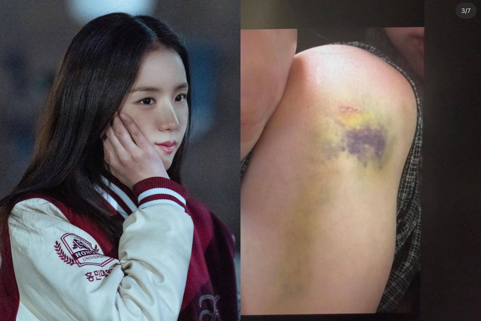 身分疑為Jisoo嫂子女性發聲了：不要連家人都責怪　遭「酷刑式家暴」仍理性發言