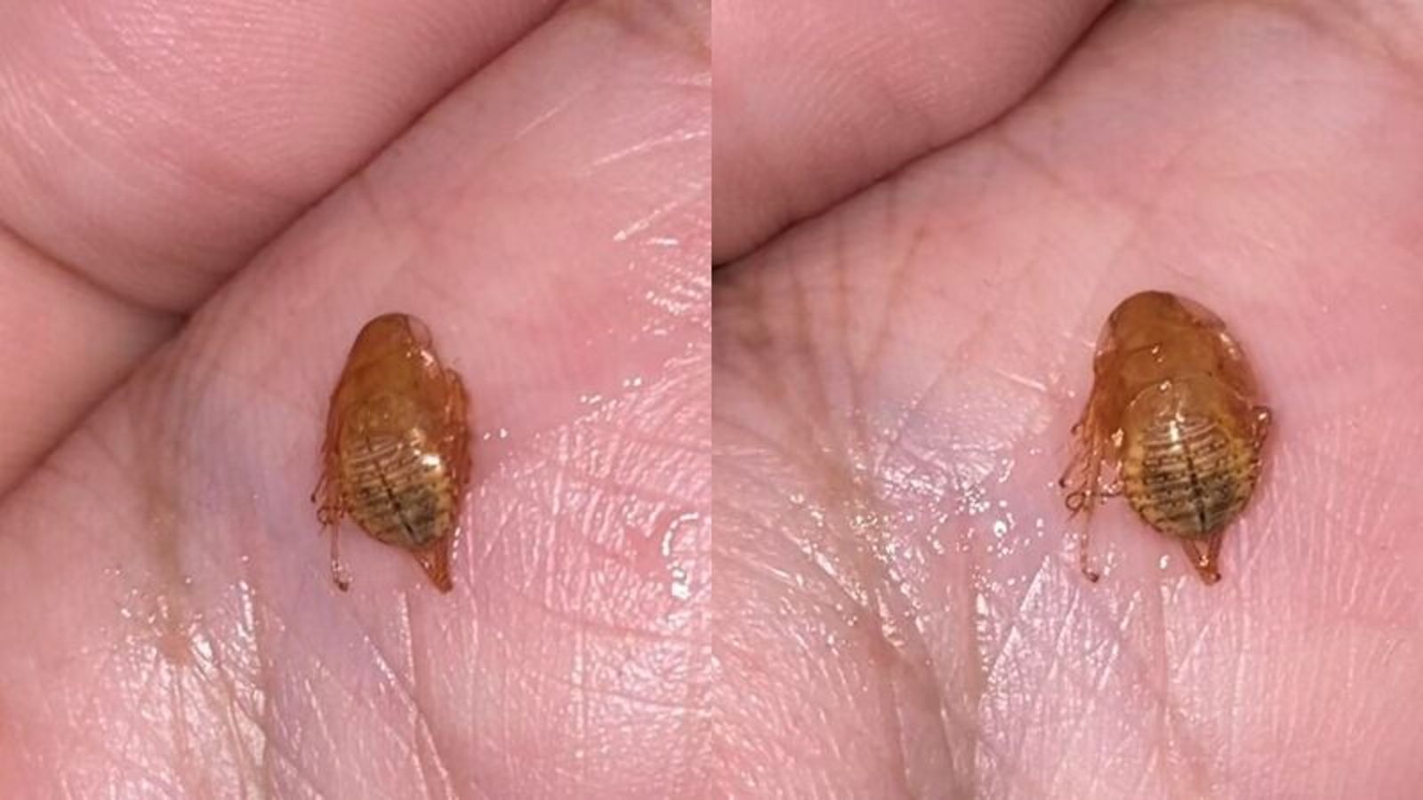 蟑螂幼蟲卡在男子喉嚨。圖／翻攝自Khaosod