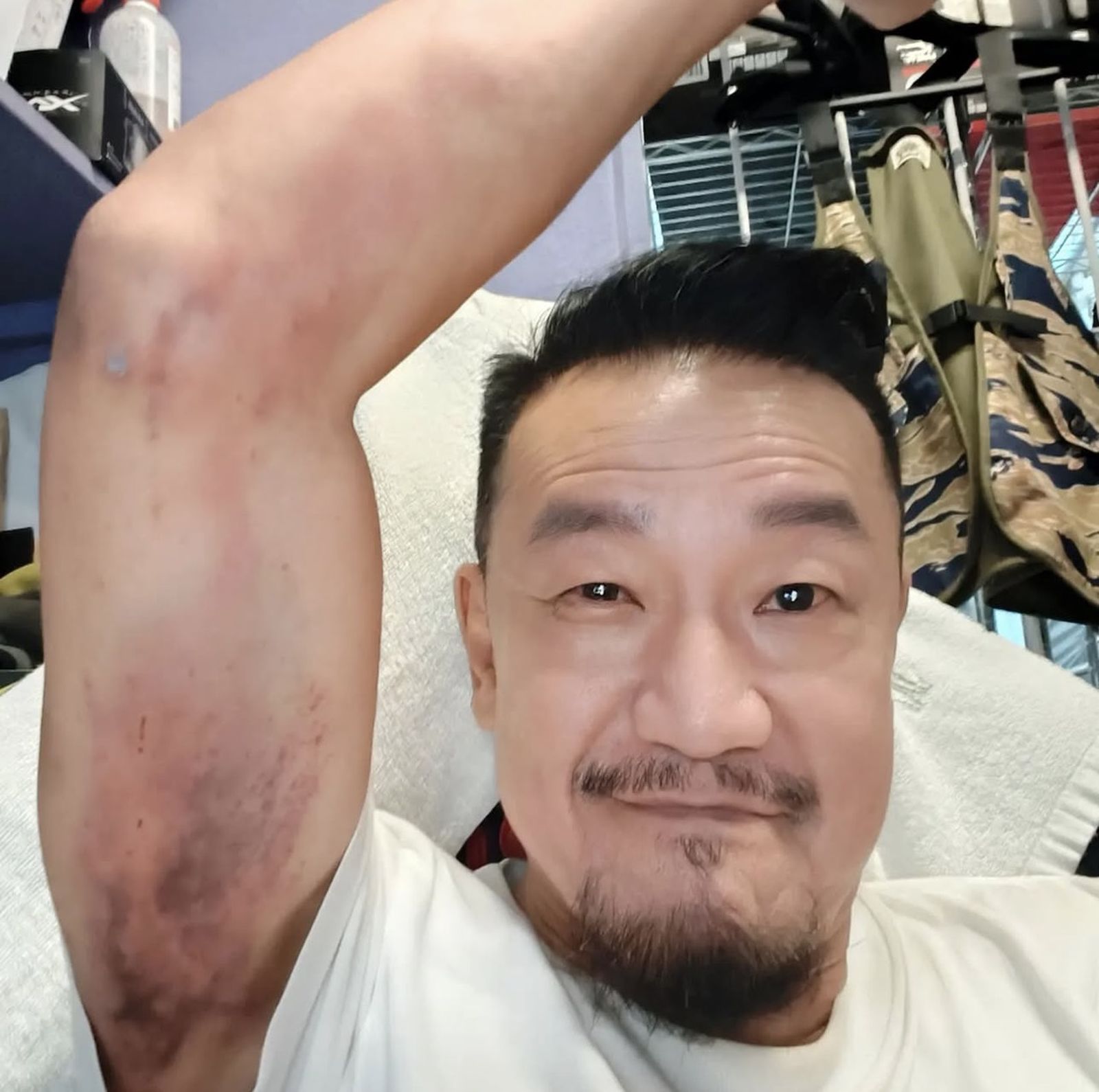 陳為民拍攝時弄得雙手都是瘀青。天予電影提供