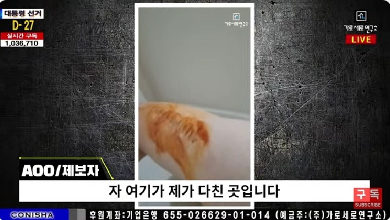 舉報者亮出他的傷勢，打臉金秀賢說他傷勢造假的說法。翻攝YT@가로세로연구소