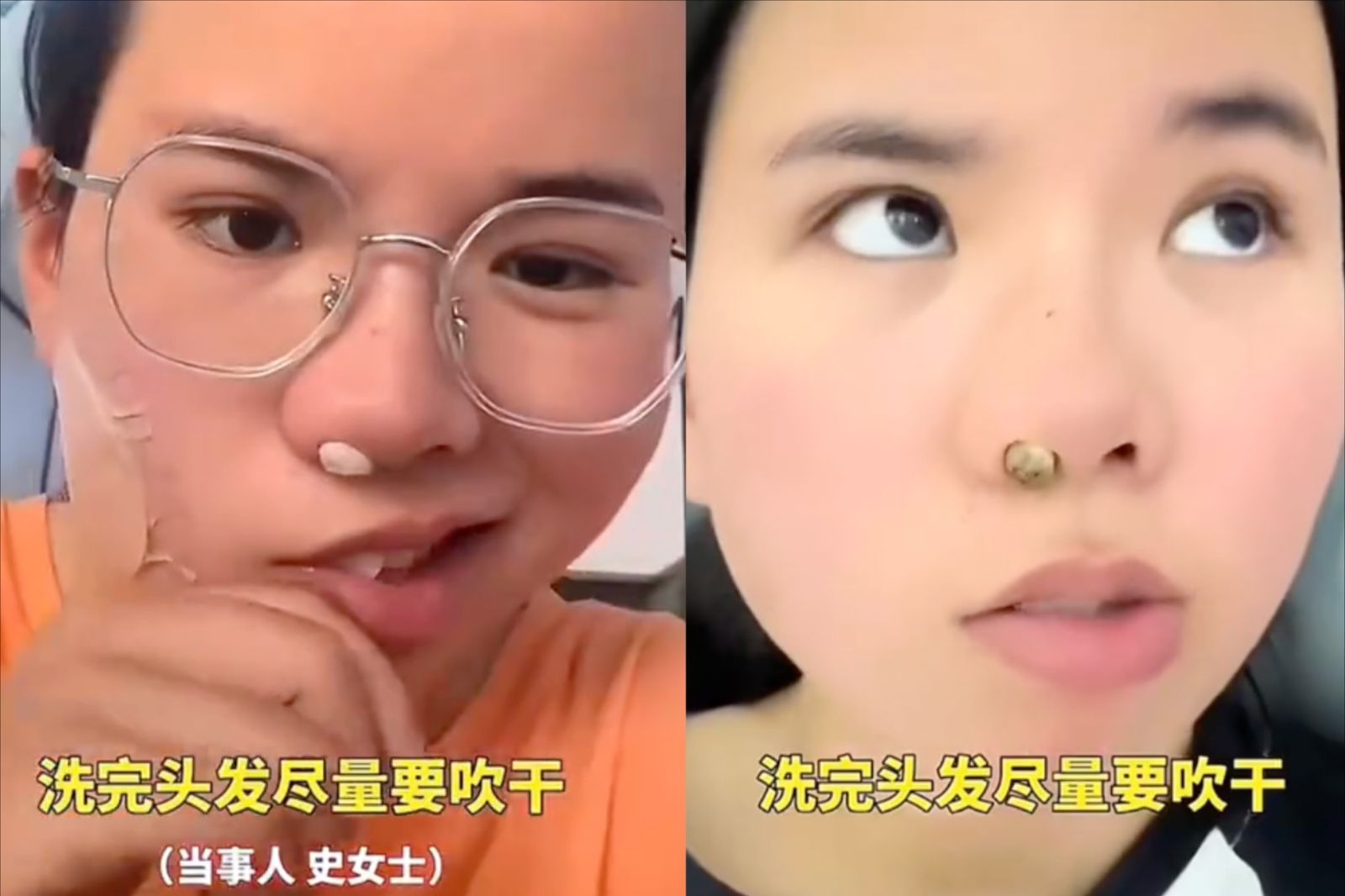 中國一名女子吹電風扇後，醒來驚覺自己「面癱」。圖／翻攝自微博