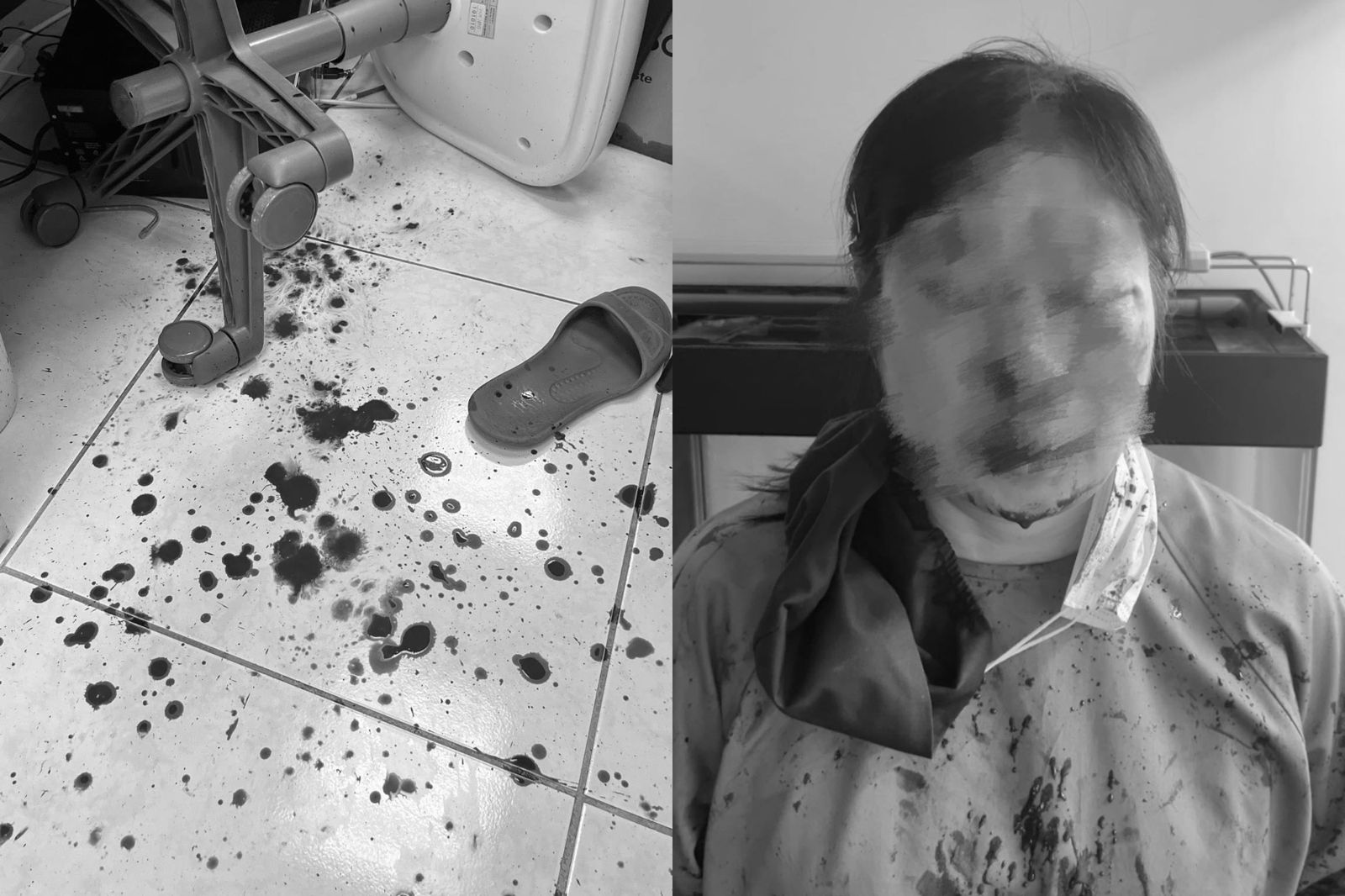 控洗牙太痛！男病患暴怒「揮拳狂毆女牙醫」　診所滿地血畫面曝