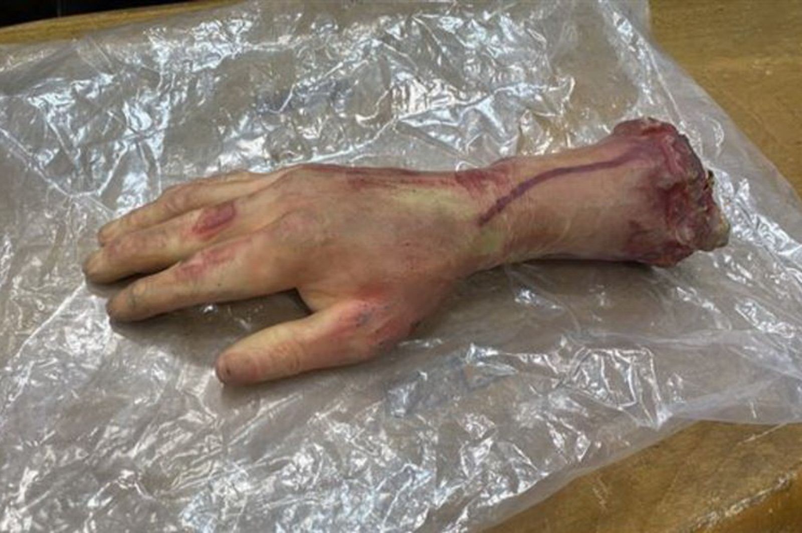 路上赫見「血斷掌」引恐慌！　失主辯「小孩放的」非故意嚇人…法官開罰理由曝