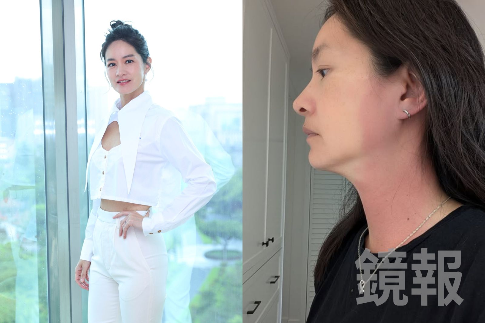 Janet高燒40度頸部腫脹像過敏　驚覺竟是更年期前兆