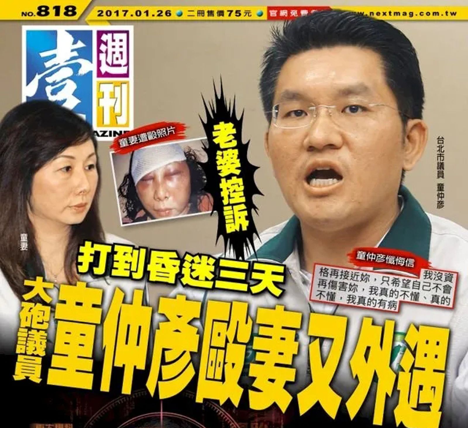 童仲彥毆妻家暴照片曝光，震驚各界。