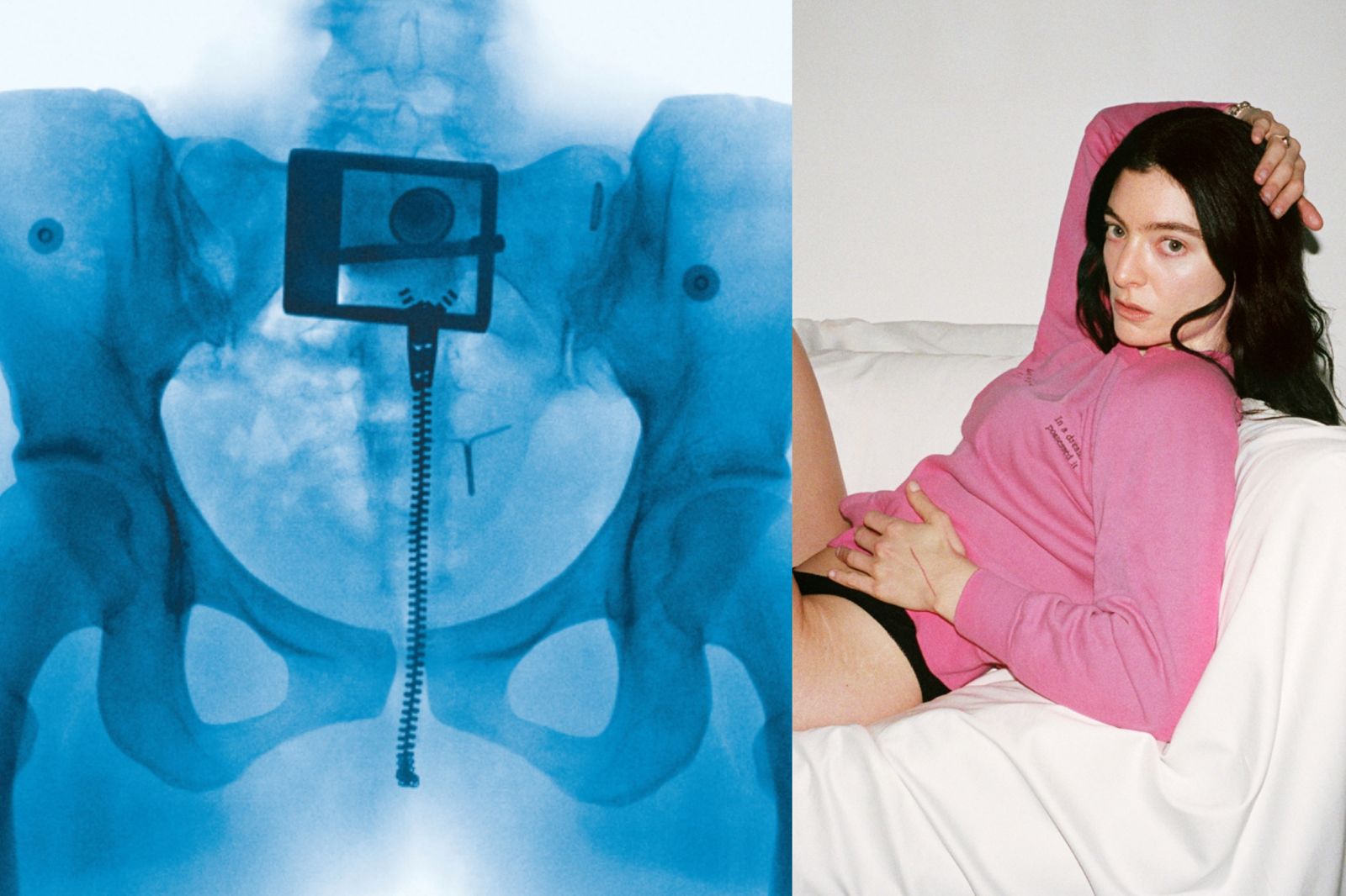 Lorde《聖女》封面挑戰尺度 骨盆X光露子宮內避孕器自剖「血淚之作」