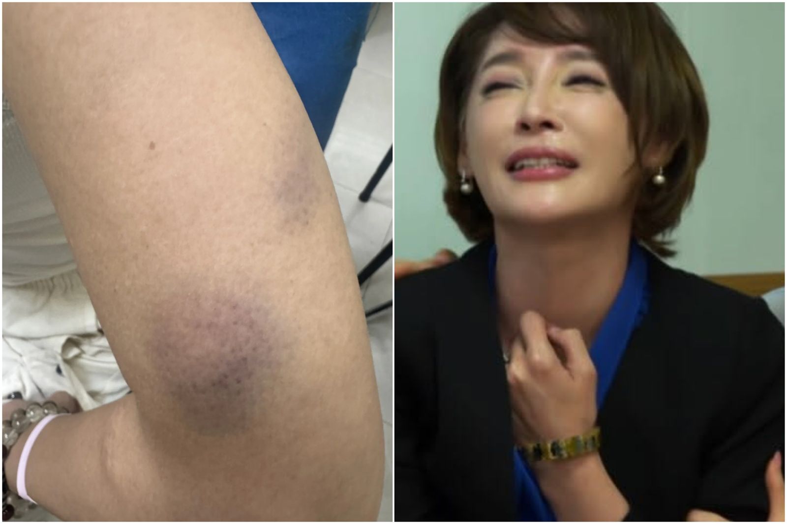 49歲李沛綾遭前夫痛毆驚人傷勢曝光!左手痛到不舉驚險單手開車北上 「弟弟」不忍心疼發聲了