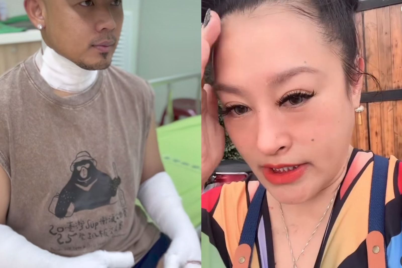 金曲歌后擺攤遇氣爆！見另一半「二度燒傷」全身裹紗布崩潰大哭