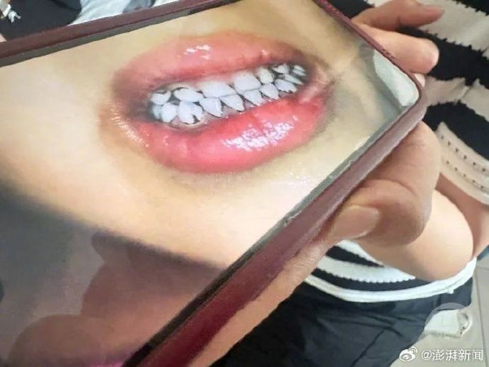鉛中毒的孩子還有牙齒發黑的情況。圖／翻攝自微博