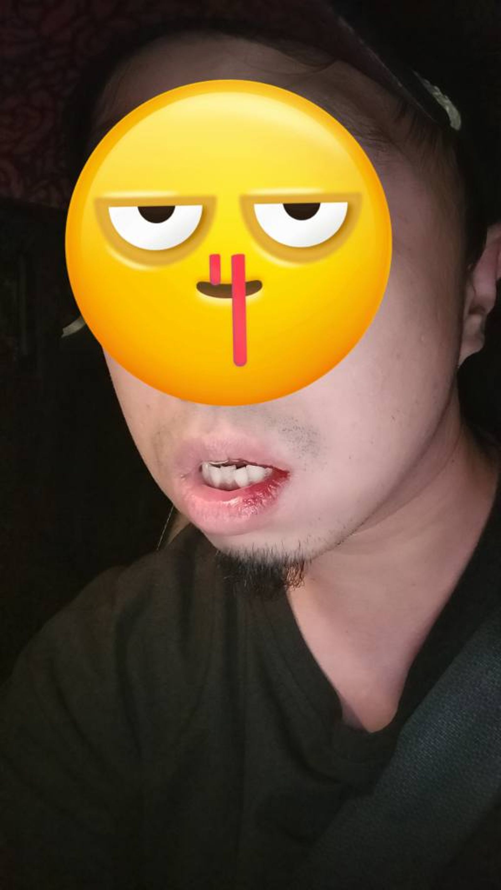 葉男遭毆造成嘴角受傷。翻攝爆料公社官方專屬