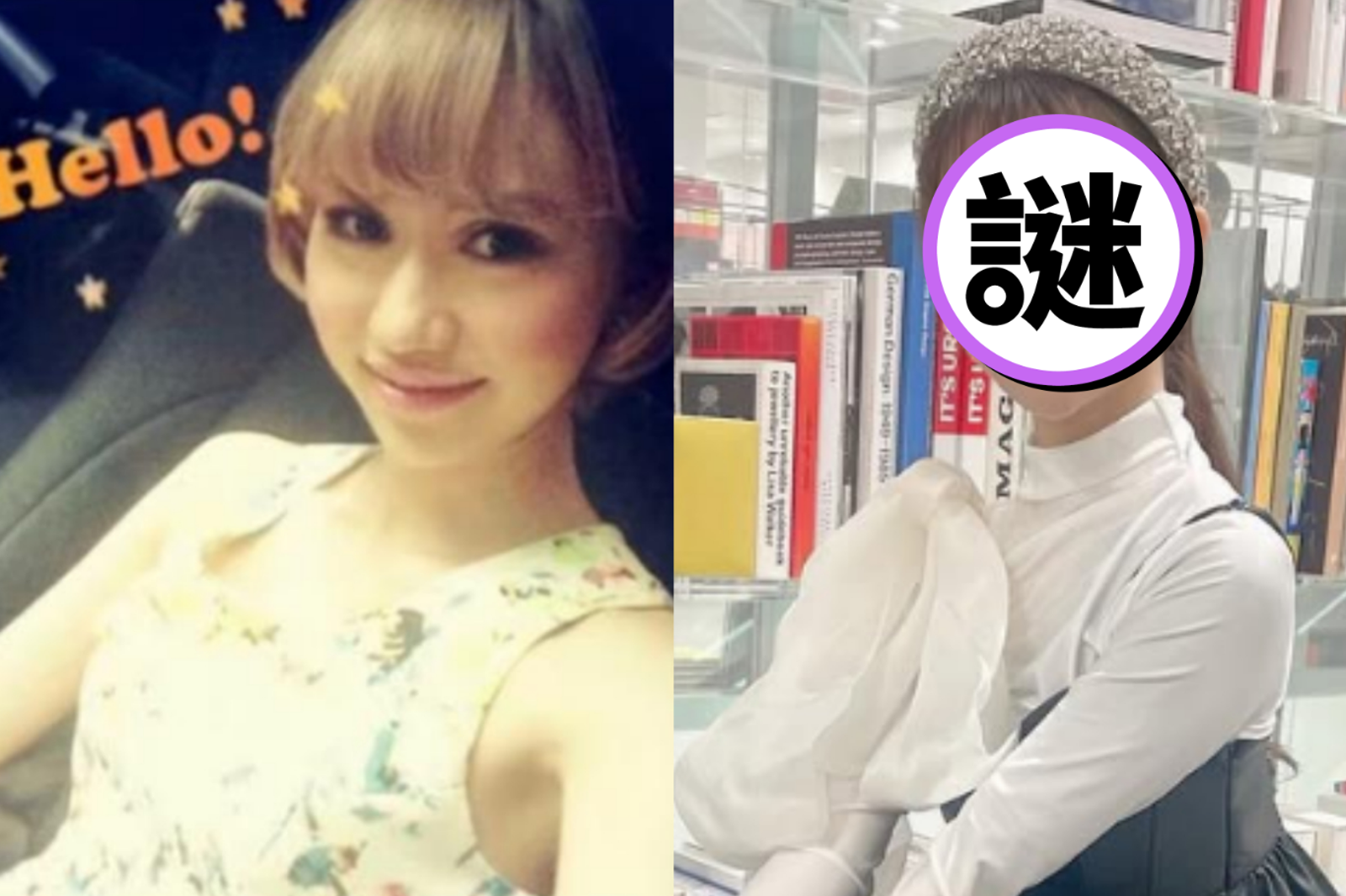 混血女星自爆「整形28次」！14歲就割雙眼皮：停不下來　臉蛋進化史超驚人