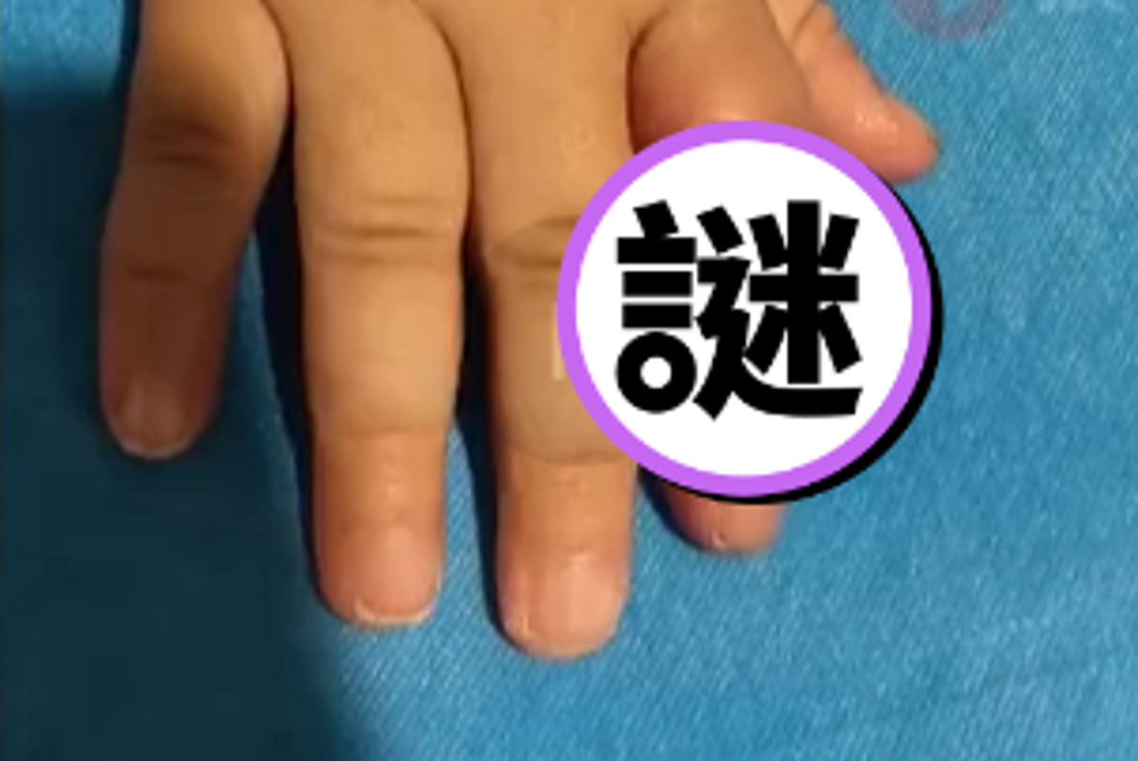 以為綑手得教訓！母為助童戒吃手險釀截肢　醫師：別誤信網路偏方
