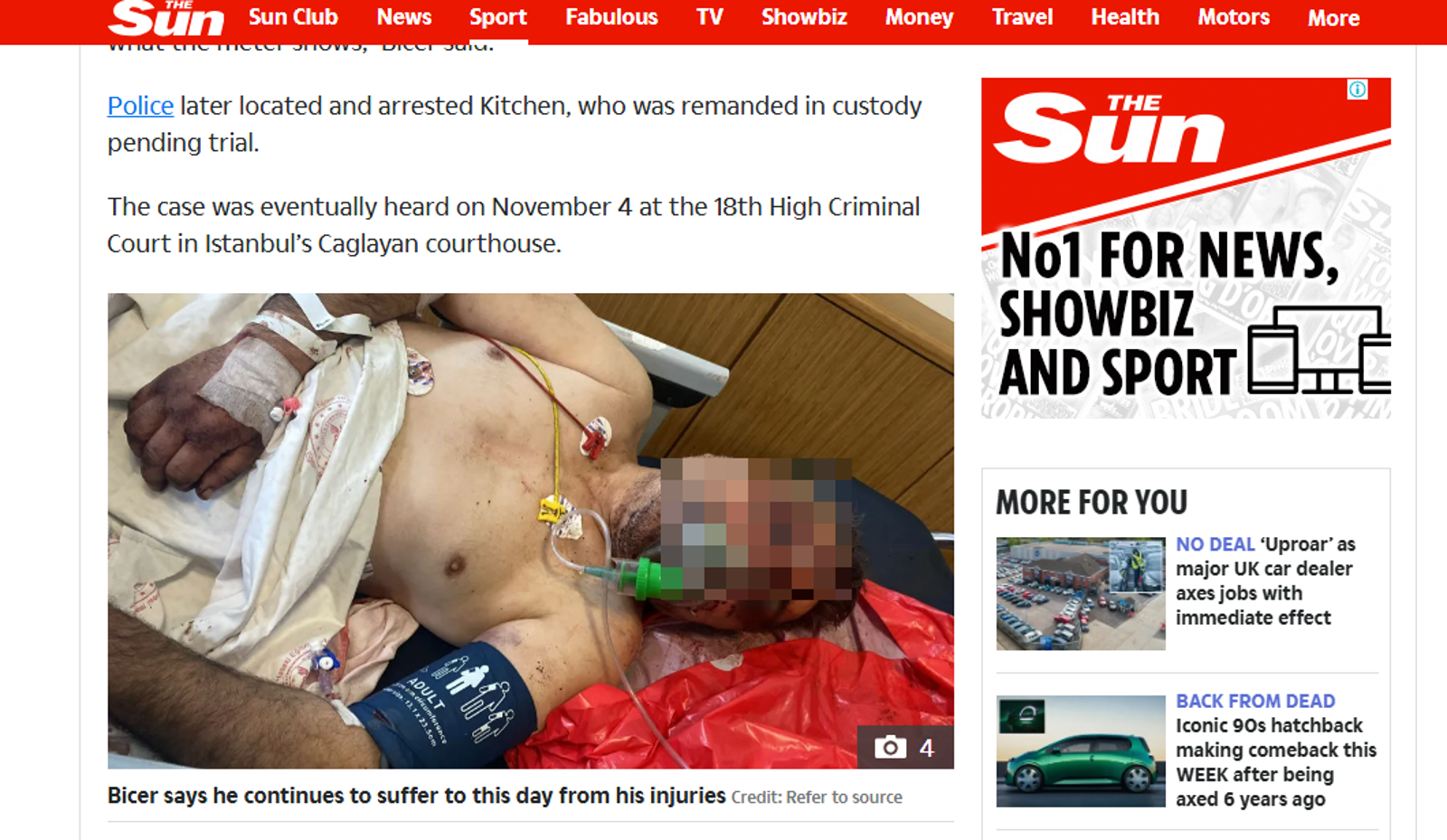 拳擊手猛毆計程車司機,勒脖「戳瞎眼睛」下場超慘。圖/翻攝自《太陽報》