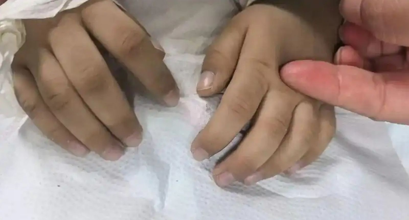 父母以為「只是氣色差」 老師堅持要檢查!3歲男童竟是「吃這東西」中毒了