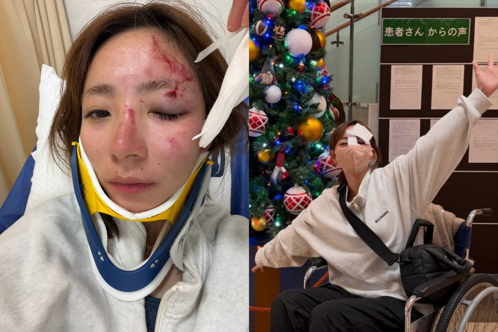 神野梓國道上車禍,因iPhone「車禍偵測」功能救了一命。圖/翻攝自IG@azu_play_