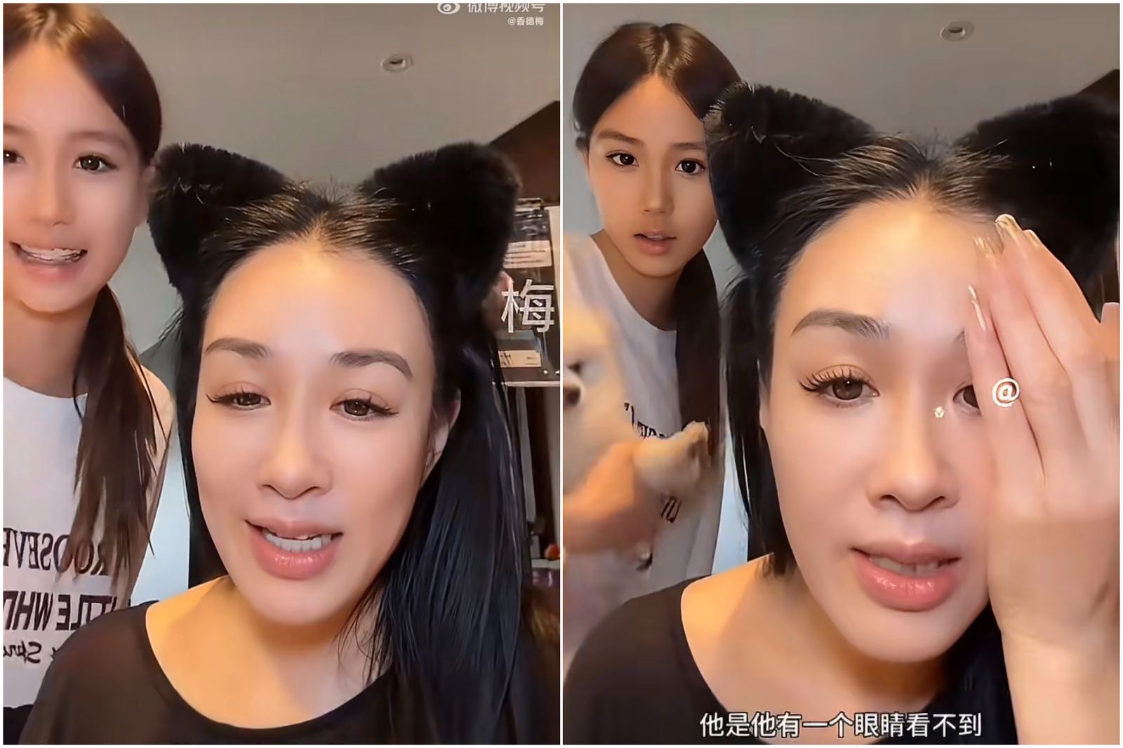 鍾麗緹震撼揭16歲小女兒「天生弱視」 自責錯失治療!出生就「一眼失明」現況曝光