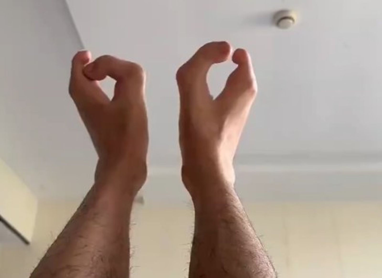 他長出牛蹄腳＋螃蟹手！竟是外公外婆「這關係」所釀…天生畸形仍撐起家庭