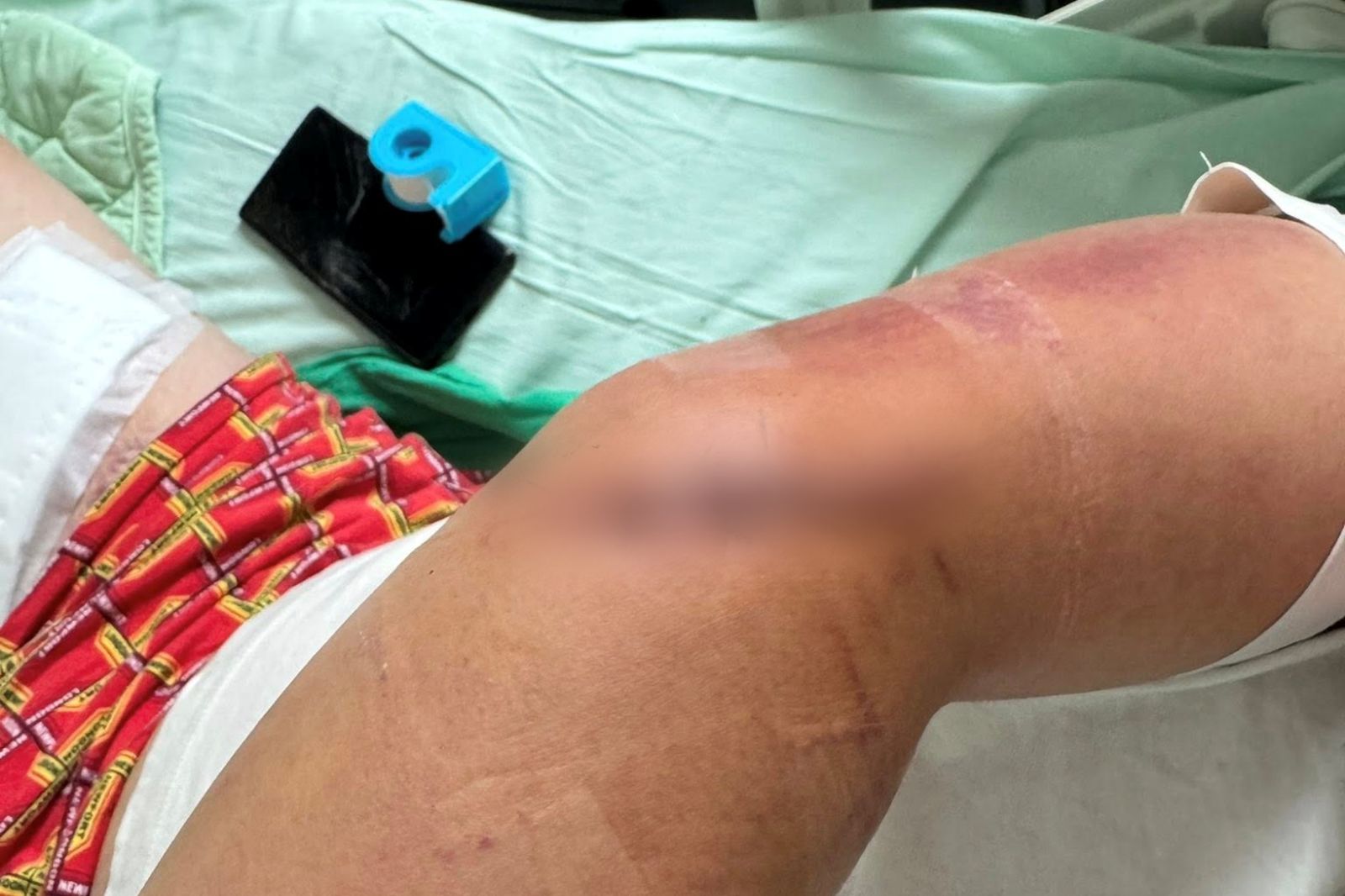 男子手臂肌腱都被砍斷了。圖／爆料公社