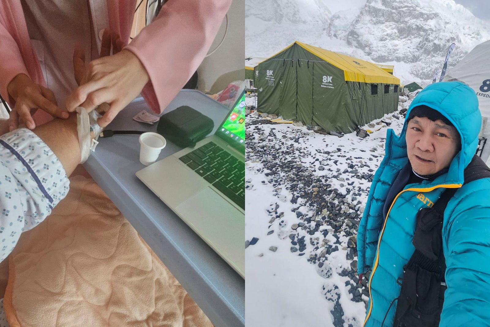 65歲眭澔平挑戰聖母峰突爆病危　腦水腫+高燒不退苦撐60小時驚險救命