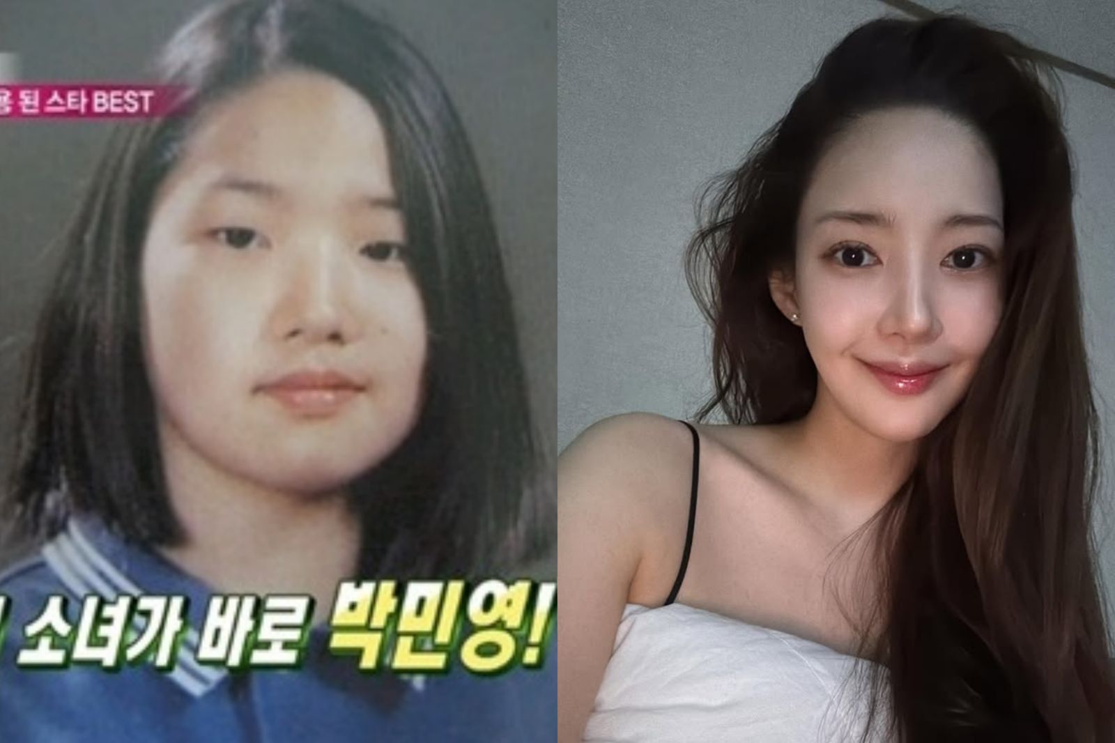 曾是李敏鎬舊愛！登韓妞「整型範本」　朴敏英奔四顏值崩壞？網驚：瘦成骷髏臉