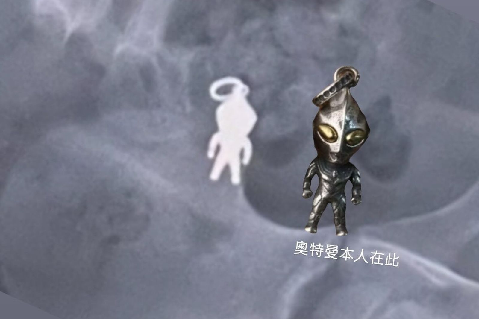 X光清楚照出奧特曼公仔模樣。圖／翻攝自Threads@shushu1011