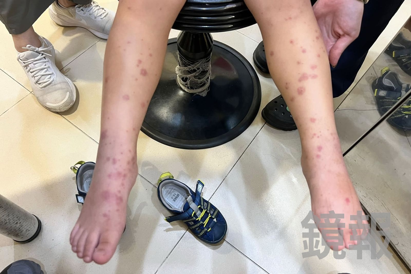 中秋團圓小心腸病毒!單周門診近1萬人次、今年7重症 醫師急提醒這3點加強防疫