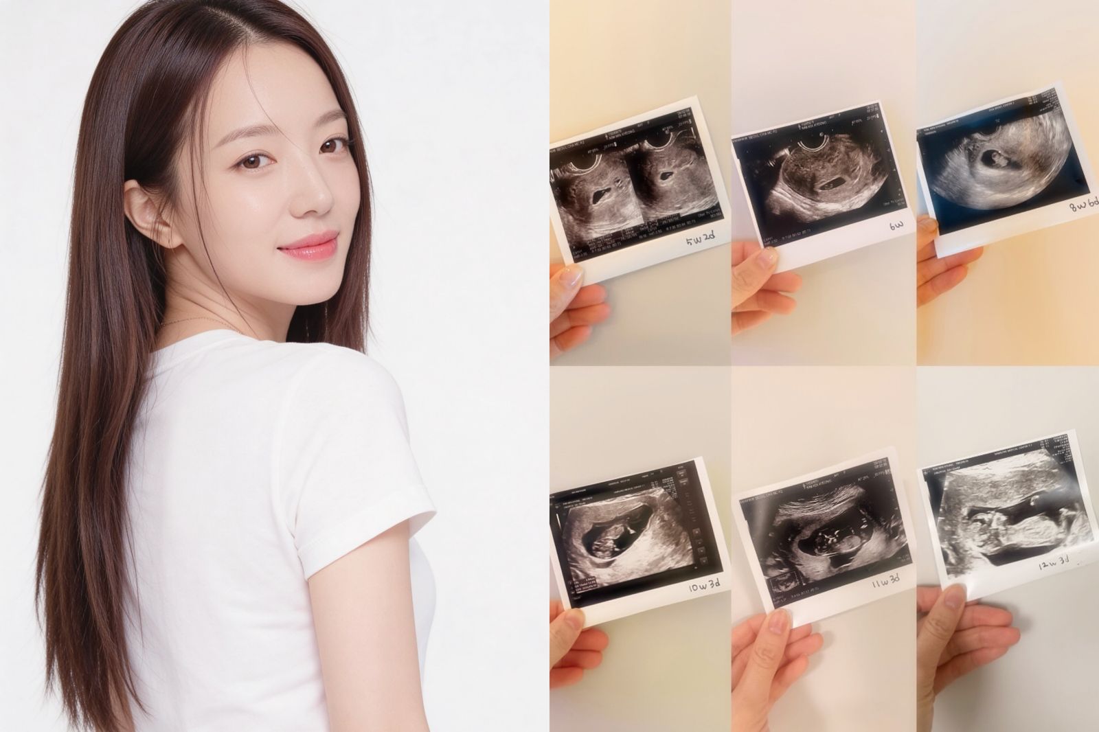 結婚2年終於等到！44歲韓國小姐冠軍懷孕14週　親曬超音波照嗨喊：上帝的回應