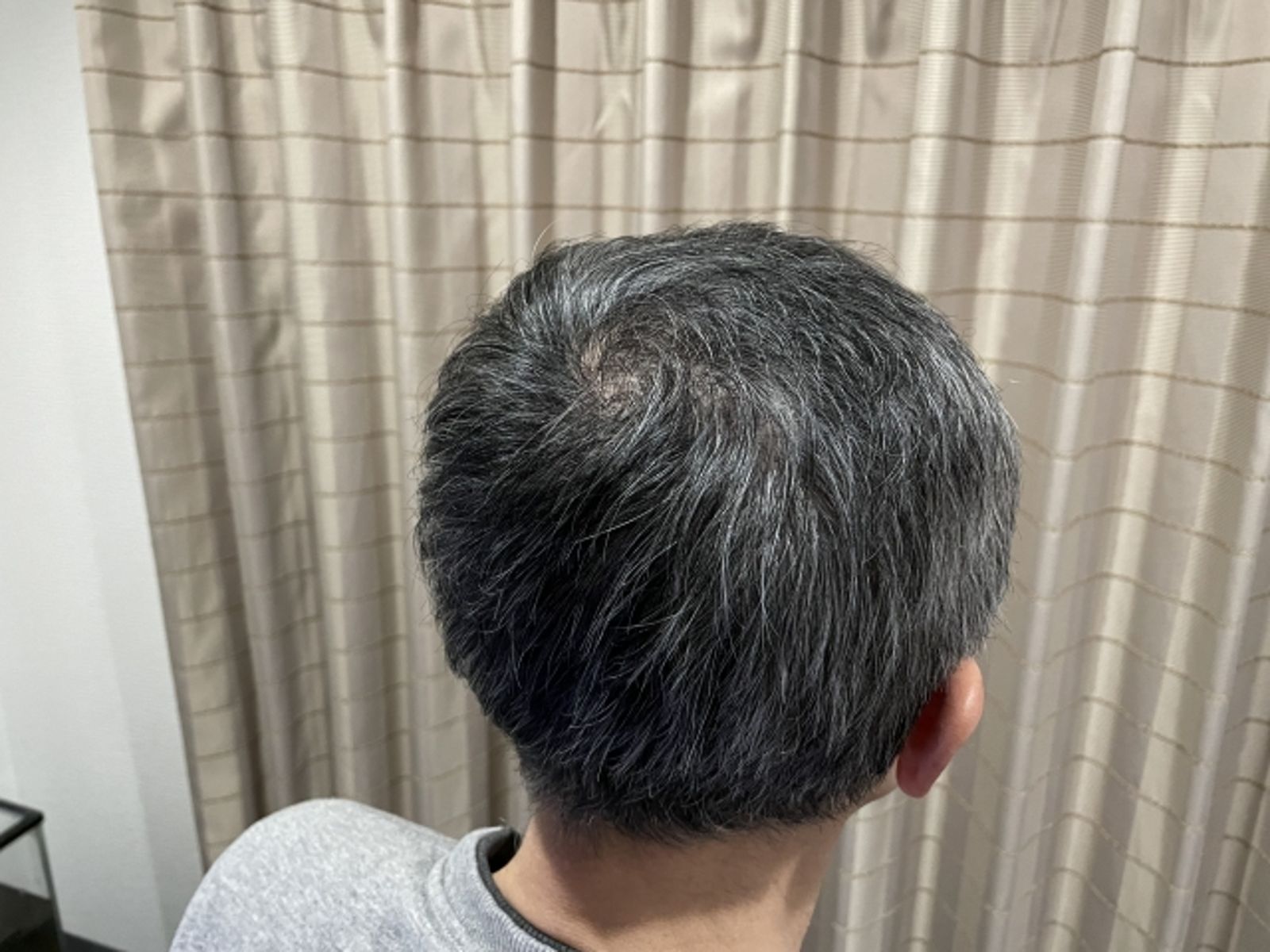 先別討厭白髮!日研究:是人體「避免癌變」自然防禦機制