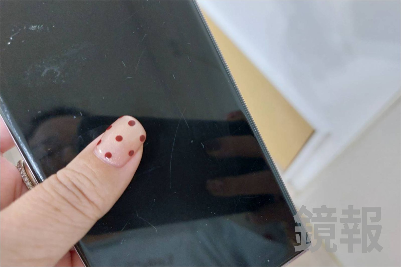 妹子拇指好痛急掛診　醫觸診她痛慘！原來得了這種「文明病」