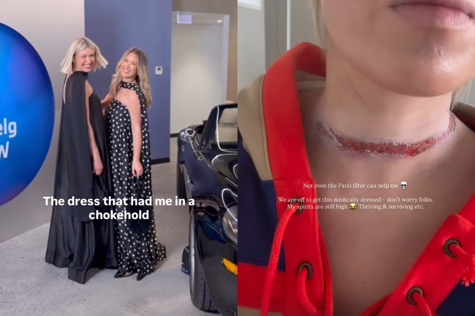 伊萊的圍巾捲入車底，造成脖子嚴重擦傷。圖／翻攝自IG／eli__moulton