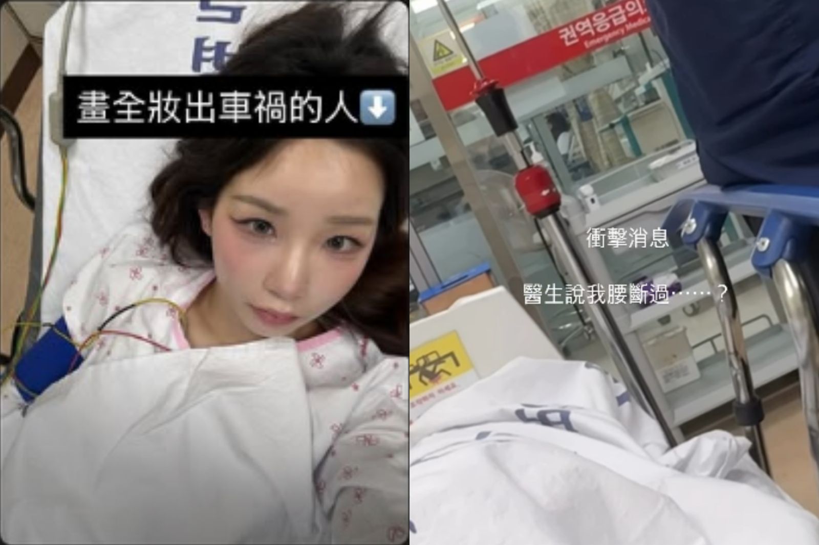 在台韓籍YouTuber國道車速80公里遭撞！醫檢查竟「腰斷過」傷勢曝光  
