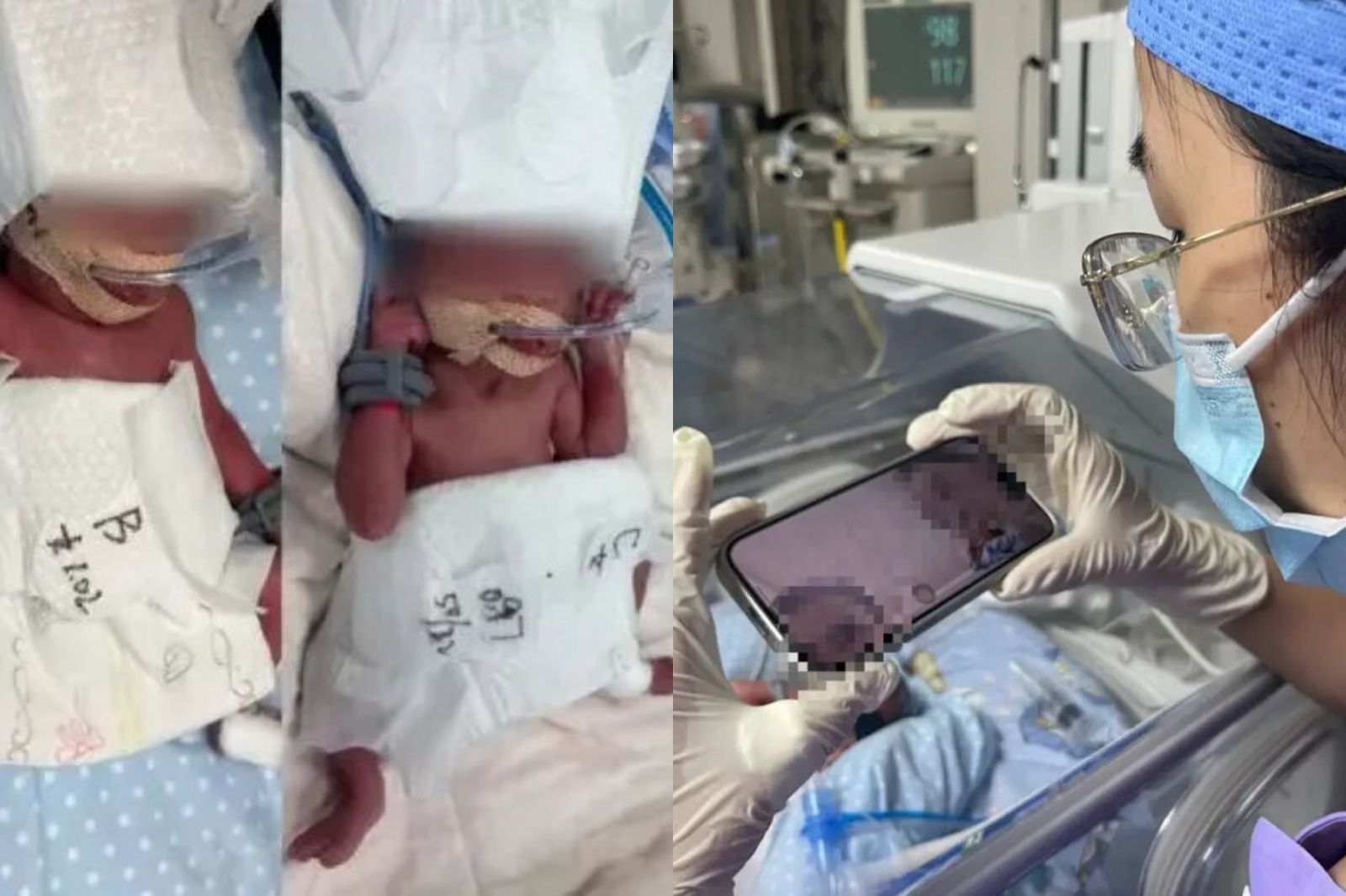 機率6千萬分之1！24歲產婦「誕下5胞胎」　醫：生命奇蹟