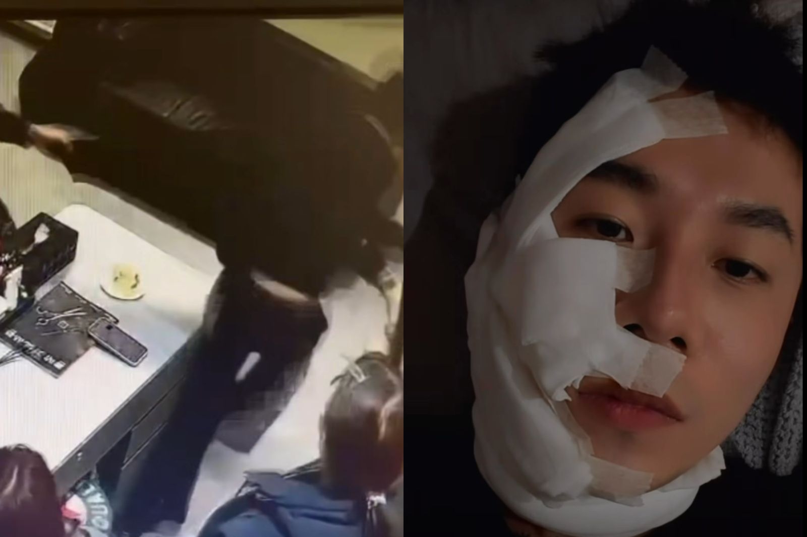 疑燙髮糾紛！28萬網紅設計師「一生叔叔」慘遭男客噴辣椒水...傷勢曝光