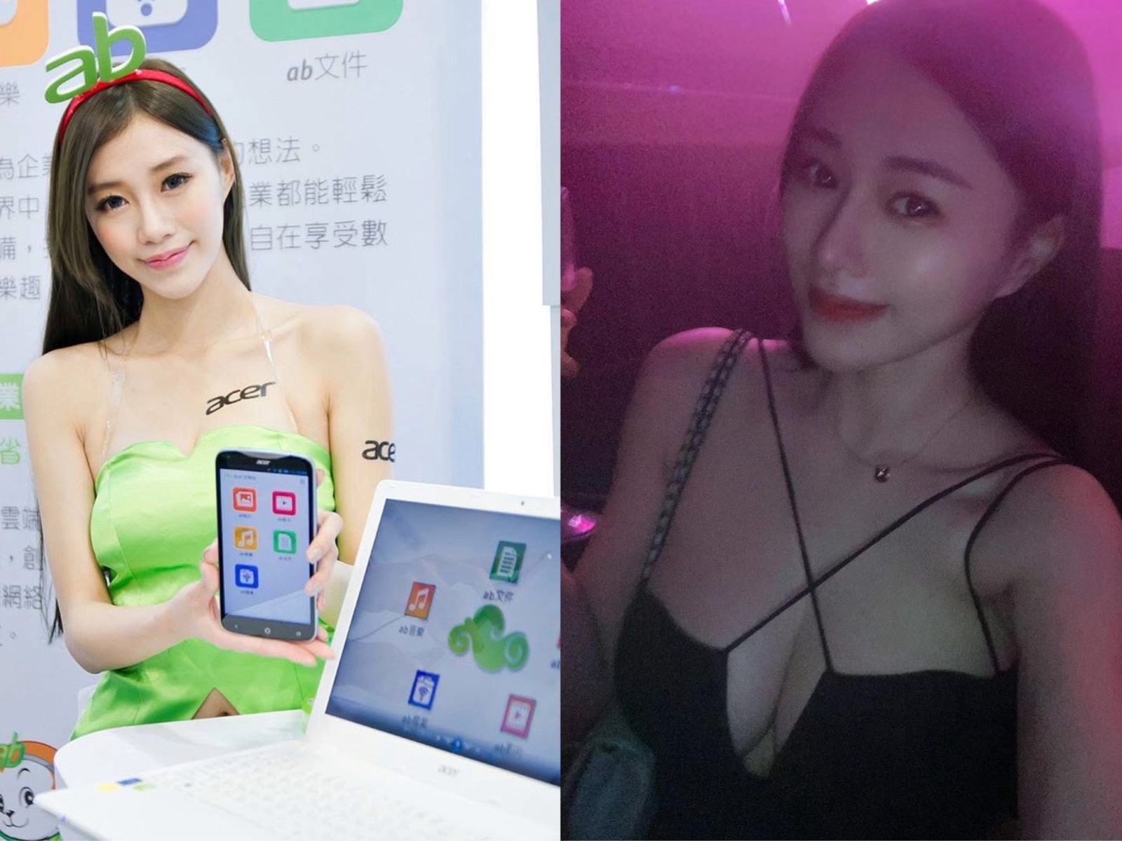 牛奶針流速暴衝5倍!車模蔡語芯命喪醫美 「1秒5滴」成關鍵疑點