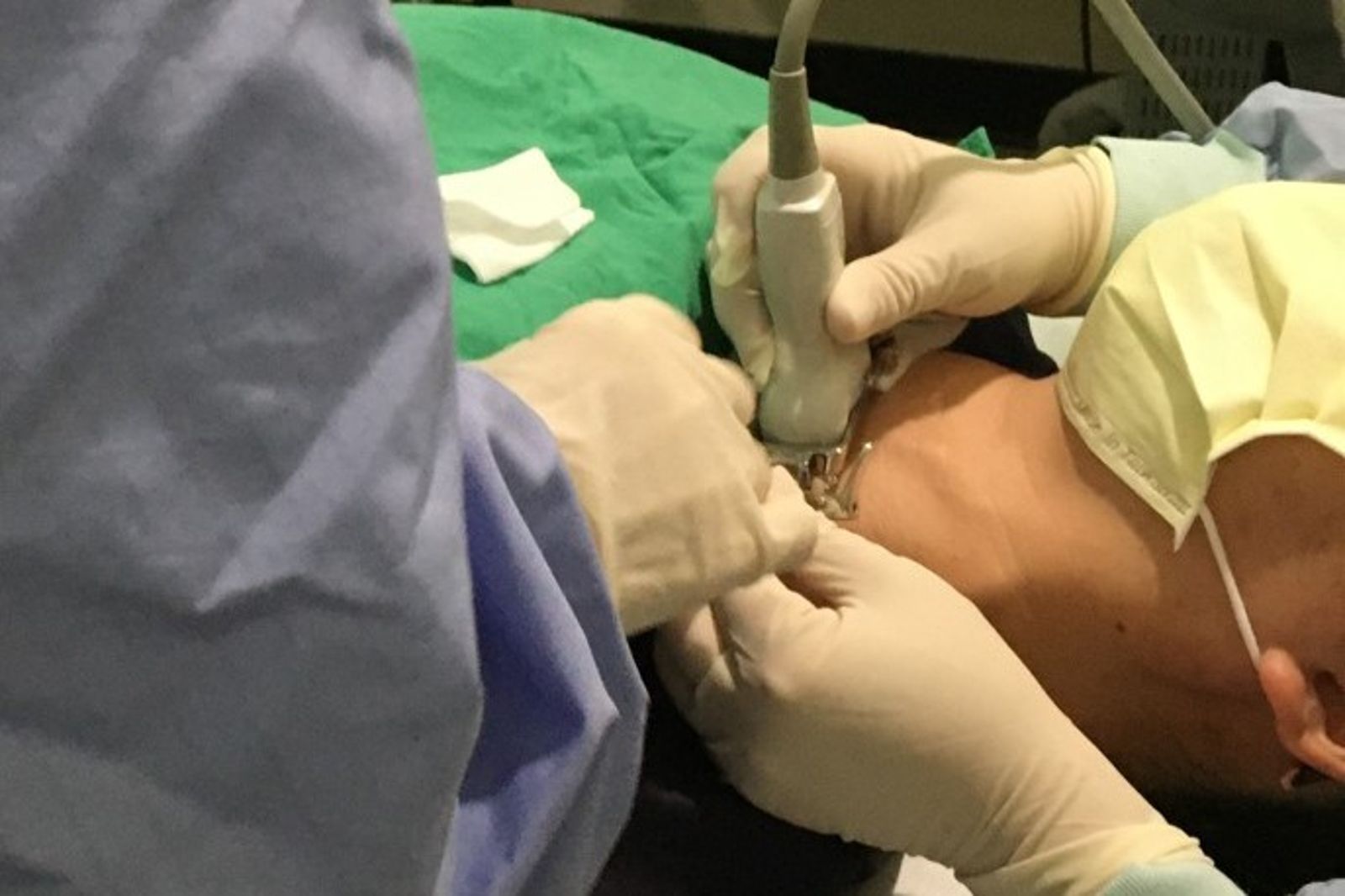 甲狀腺結節新療法！微創消融術免開刀、不留疤、隔天就能出院