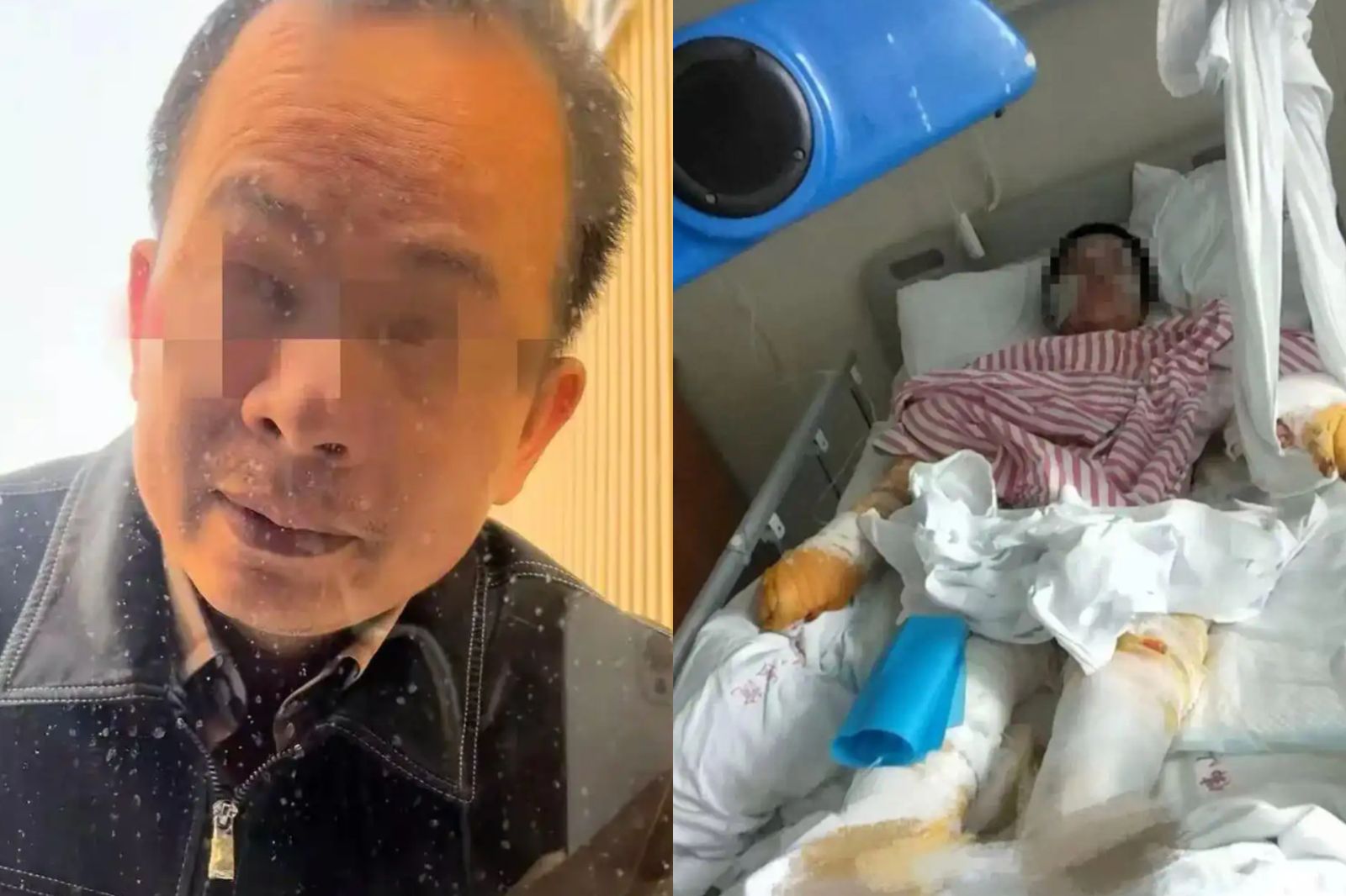拒絕追求遭「亂刀猛殺+潑硫酸」!等3年兇手終於伏法…她嘆:人生回不去了