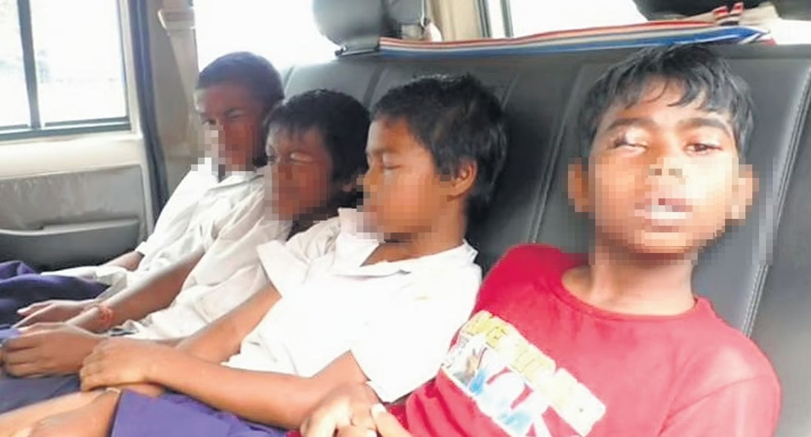 8住宿生起床「睜不開眼」急送醫！竟是遭「強力膠黏住」惡作劇屁孩還沒抓到