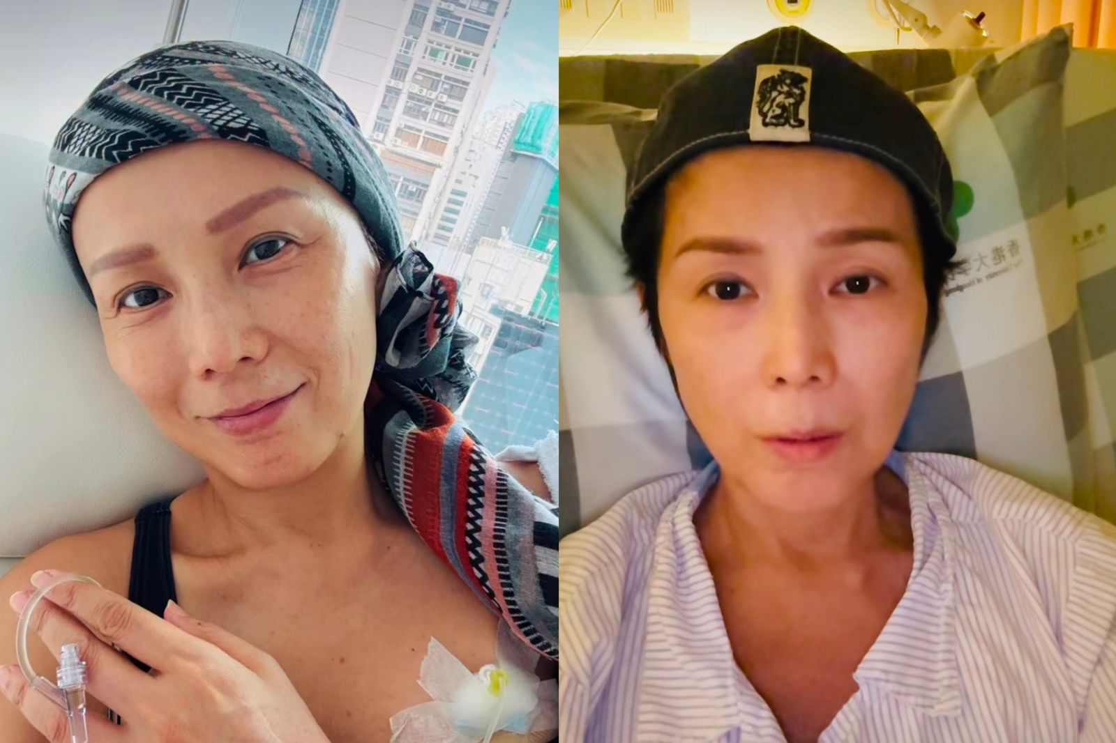 51歲女星乳癌四期擴散大腦!肺炎纏身化療喊卡 無奈證實:出院無期