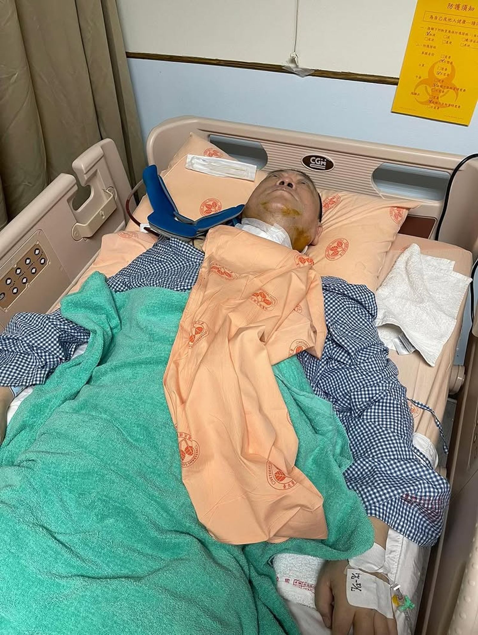 孫德榮9小時的手術順利完成，發文報平安。翻攝Instagram @sunzhong_is_here