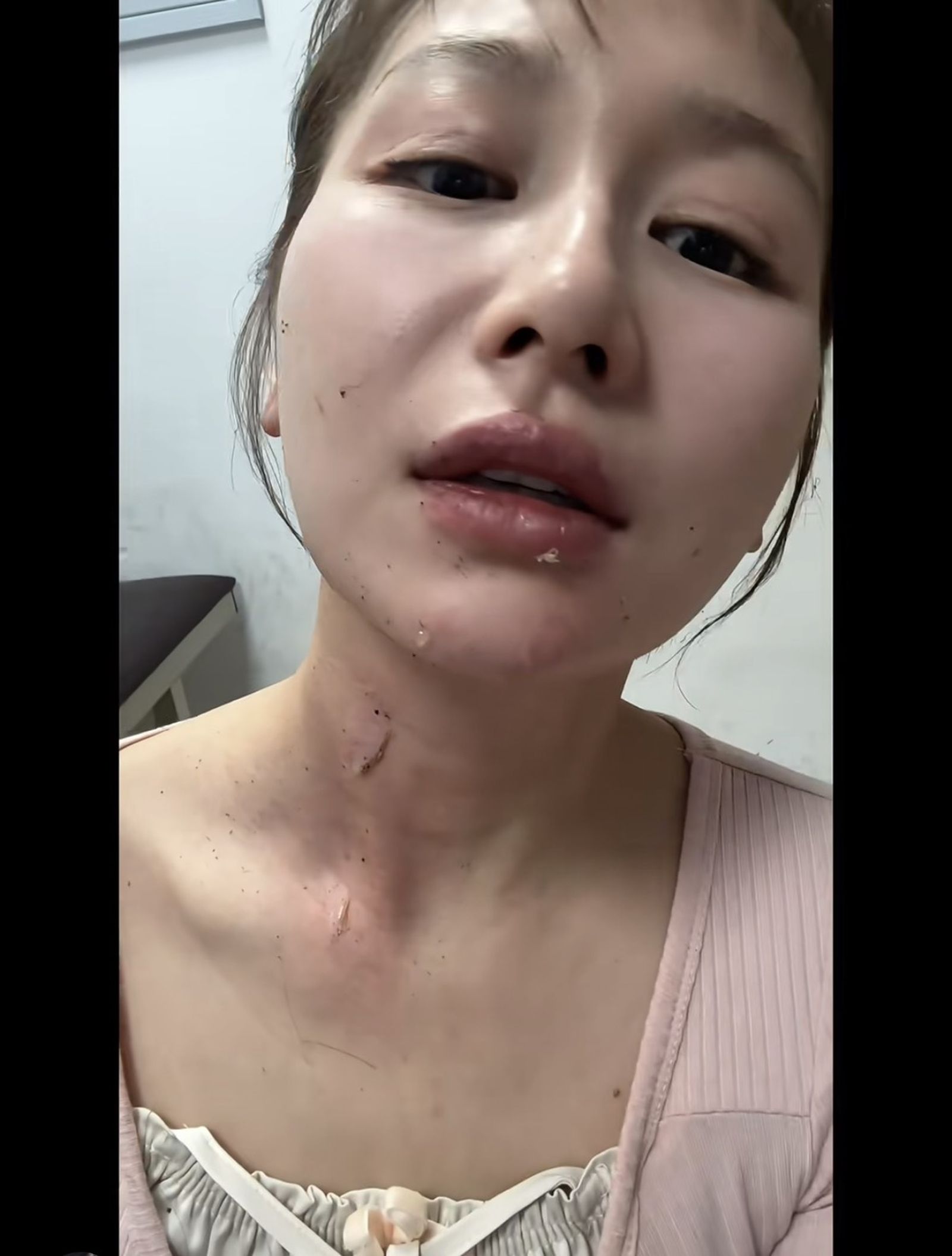 王添羽曝光傷勢狀況。翻攝小紅書